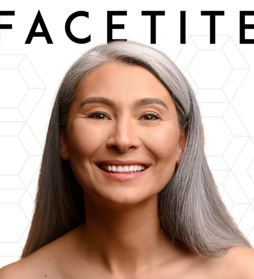 5 FaceTite Facts for Skin Contouring